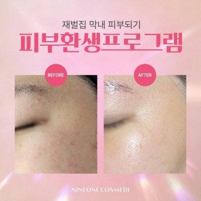 목포역부근피부관리 샵