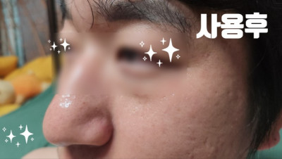 Visblanc 비즈블랑 2스텝 마스크팩