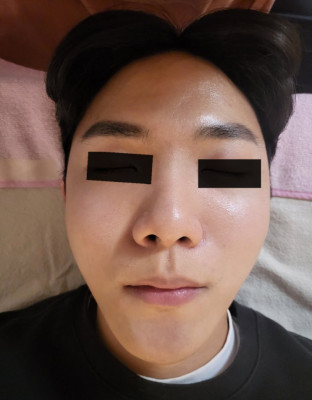 [대전] 복수동 피부 얼굴 부분 두피관리 뷰티샵 , 앨리스뷰티